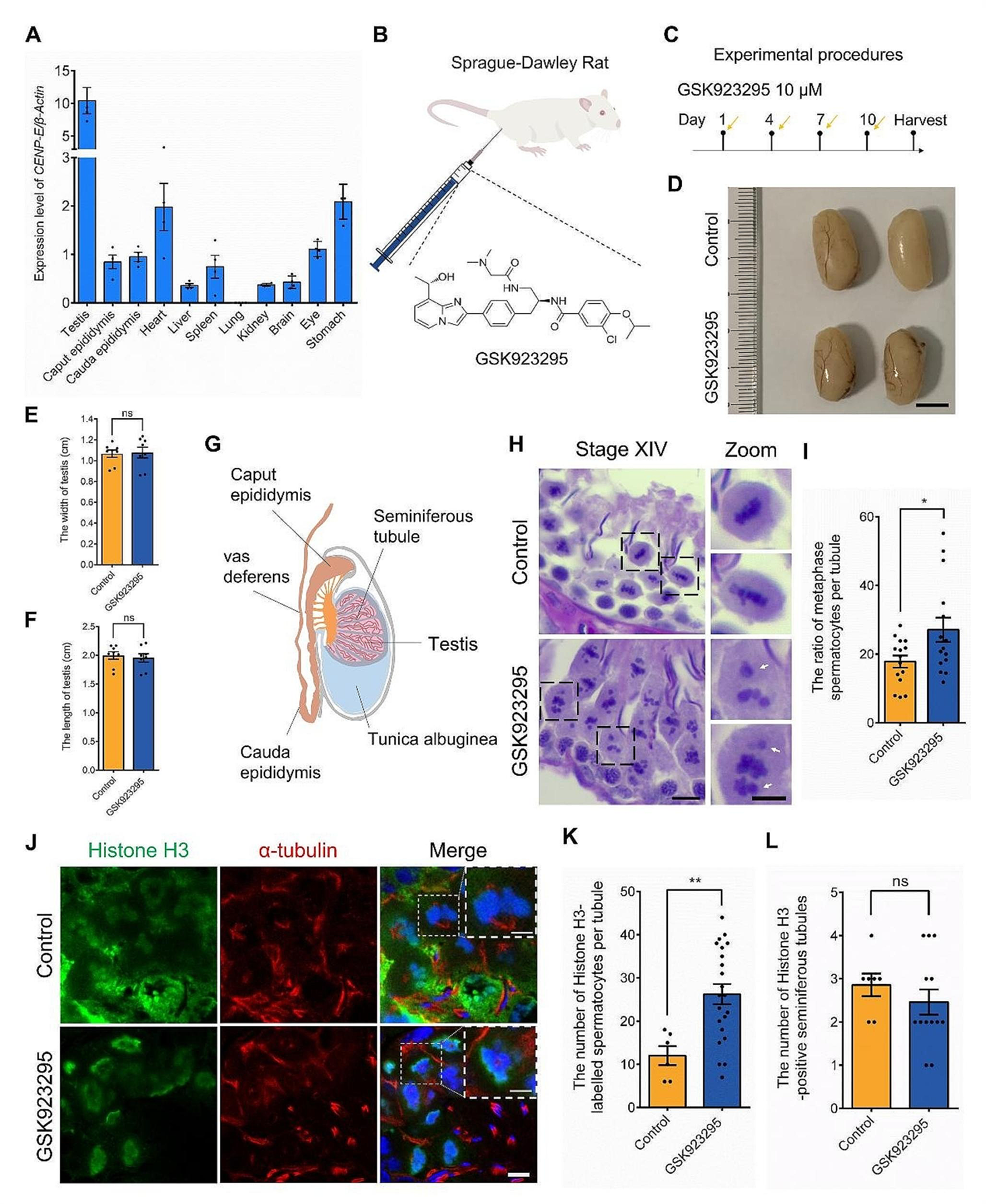 Kinesin-7 CENP-E mediates chromosome alignment and spindle assembly checkpoint in meiosis I