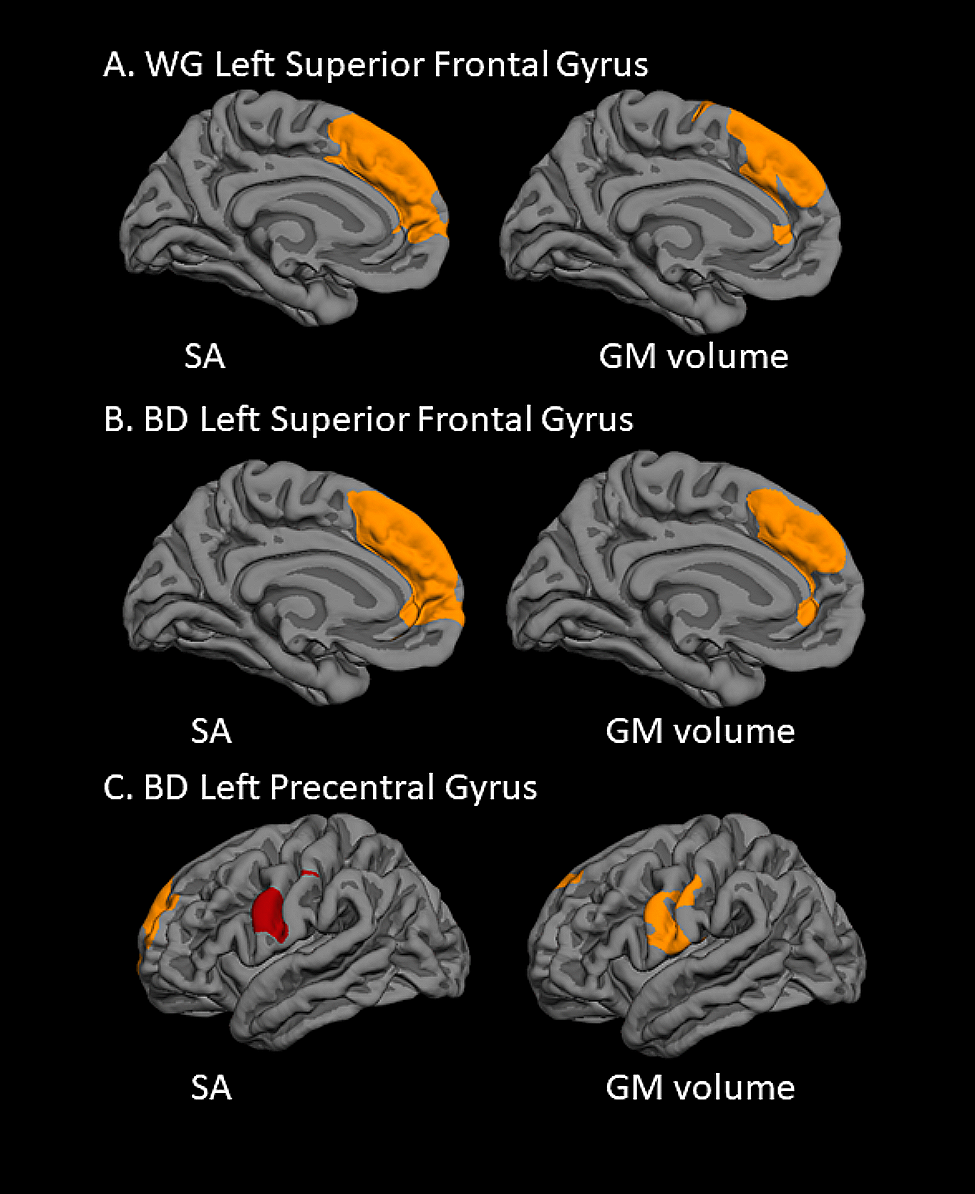 Pilot study of circulating cell-free mitochondrial DNA in relation to brain structure in youth bipolar disorder