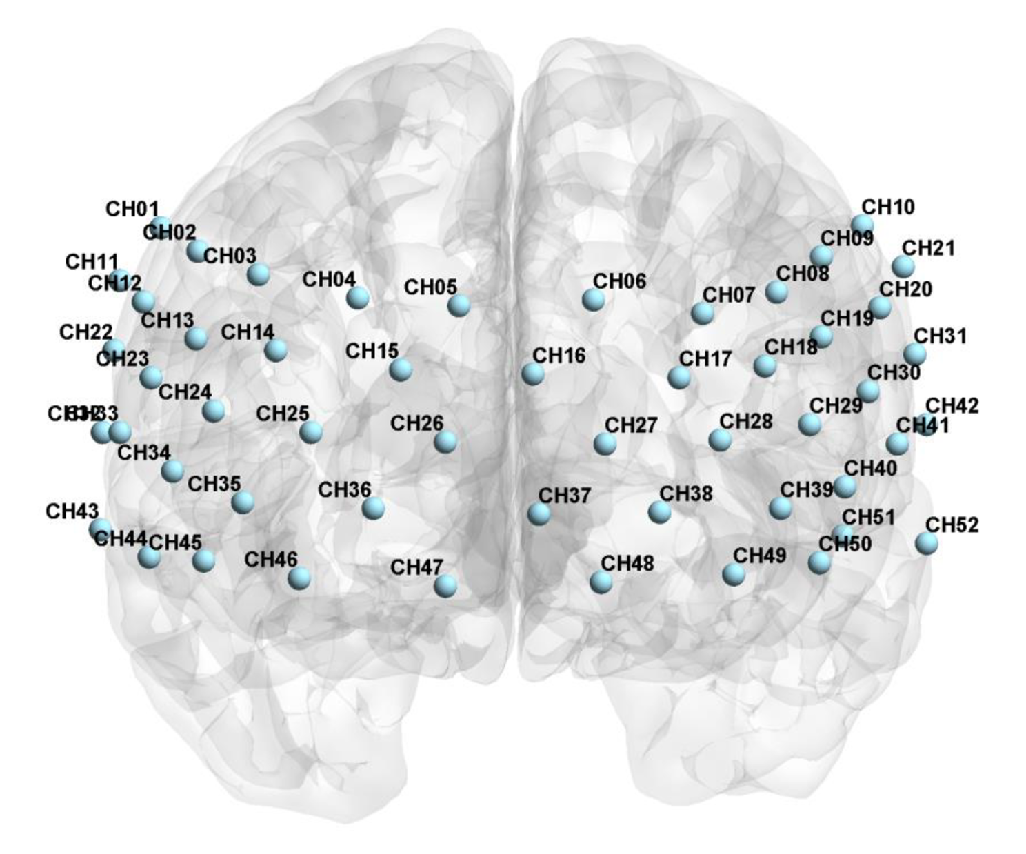 Cortical activation for adolescent-onset minor depression and major depressive disorder: an fNIRS study