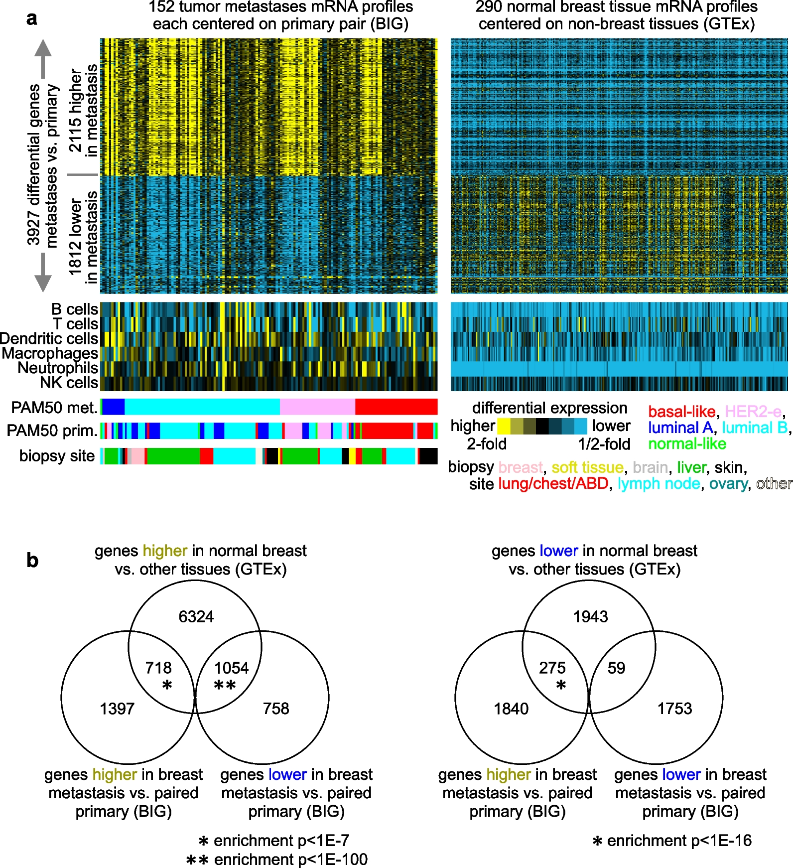 An essential gene signature of breast cancer metastasis reveals targetable pathways