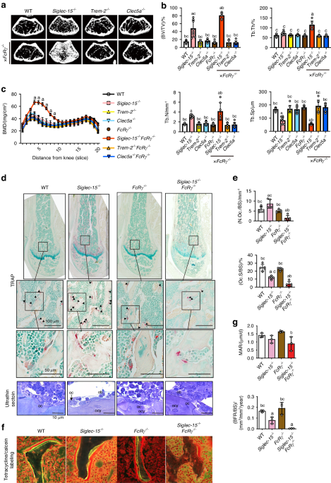 Involvement of Siglec-15 in regulating RAP1/RAC signaling in cytoskeletal remodeling in osteoclasts mediated by macrophage colony-stimulating factor
