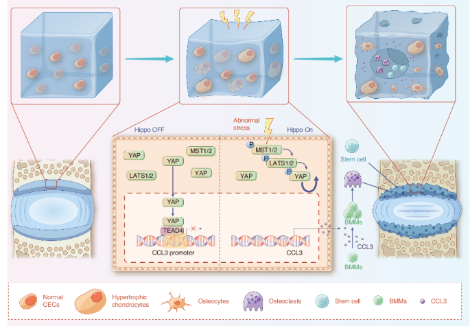 Lumbar instability remodels cartilage endplate to induce intervertebral disc degeneration by recruiting osteoclasts via Hippo-CCL3 signaling