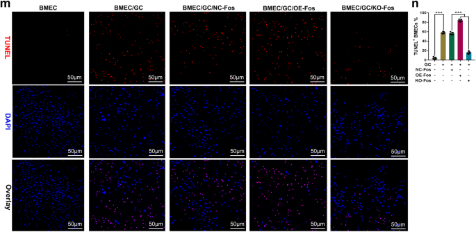 Author Correction: FAR591 promotes the pathogenesis and progression of SONFH by regulating Fos expression to mediate the apoptosis of bone microvascular endothelial cells