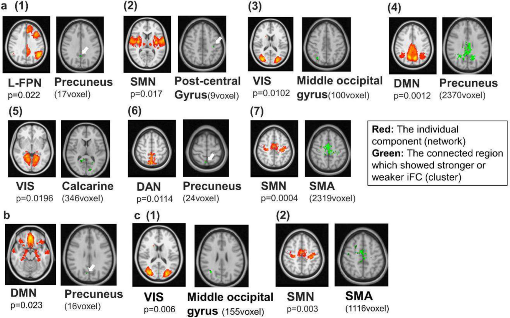 Correlation of altered intrinsic functional connectivity with impaired self-regulation in children and adolescents with ADHD
