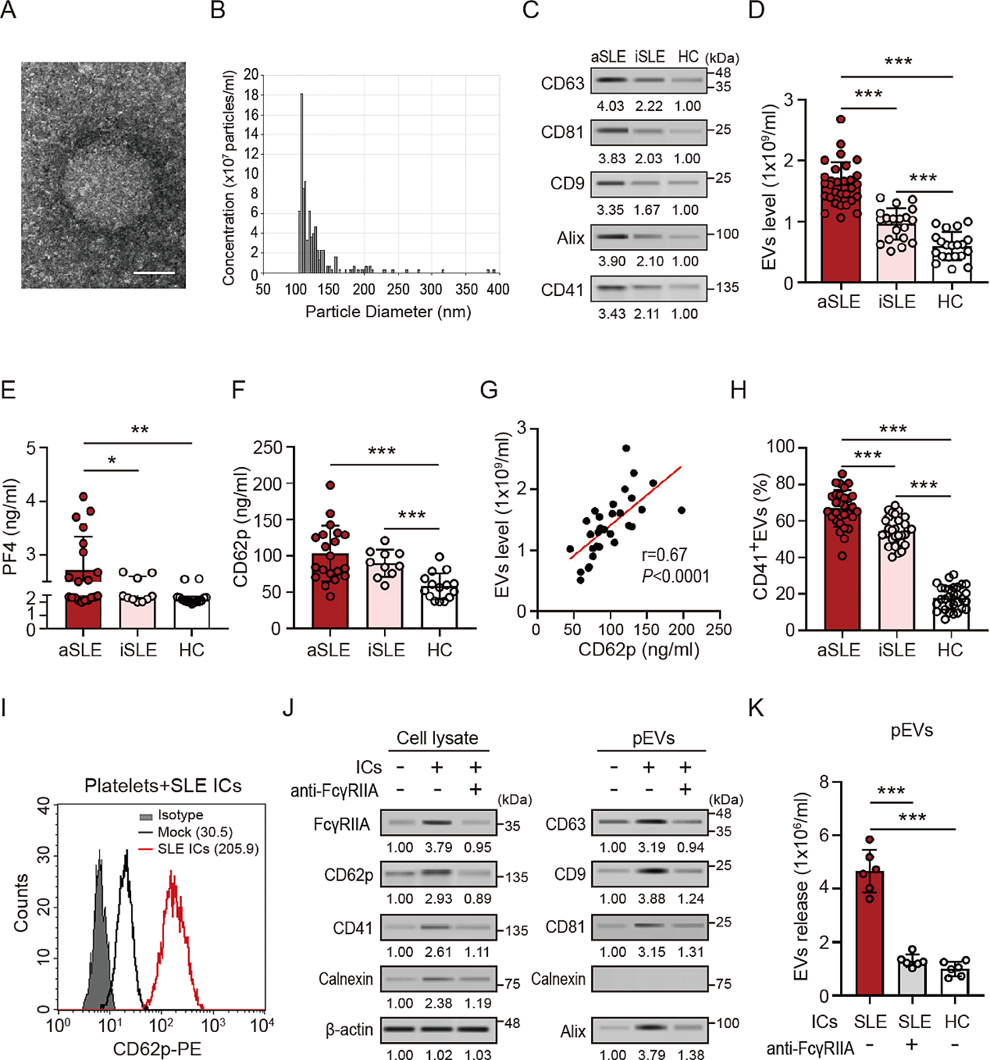 tRF-His-GTG-1 enhances NETs formation and interferon-α production in lupus by extracellular vesicle