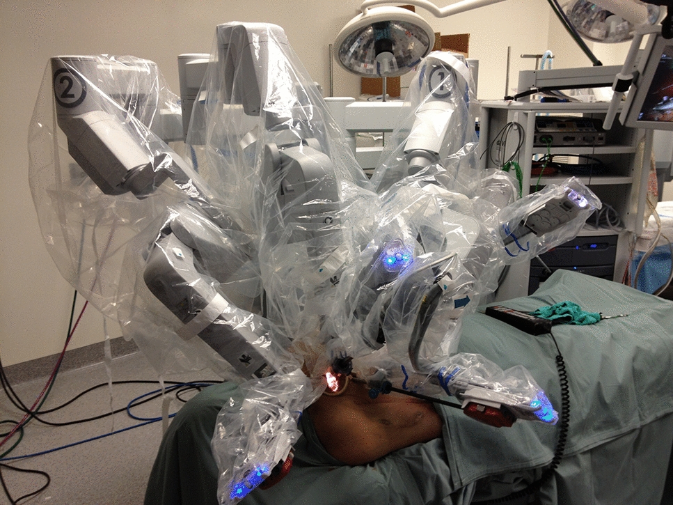 Robotically assisted outflow graft anastomosis in minimally invasive left-ventricular assist device implantation: feasibility, surgeon comfort, and operative times in an anatomical study