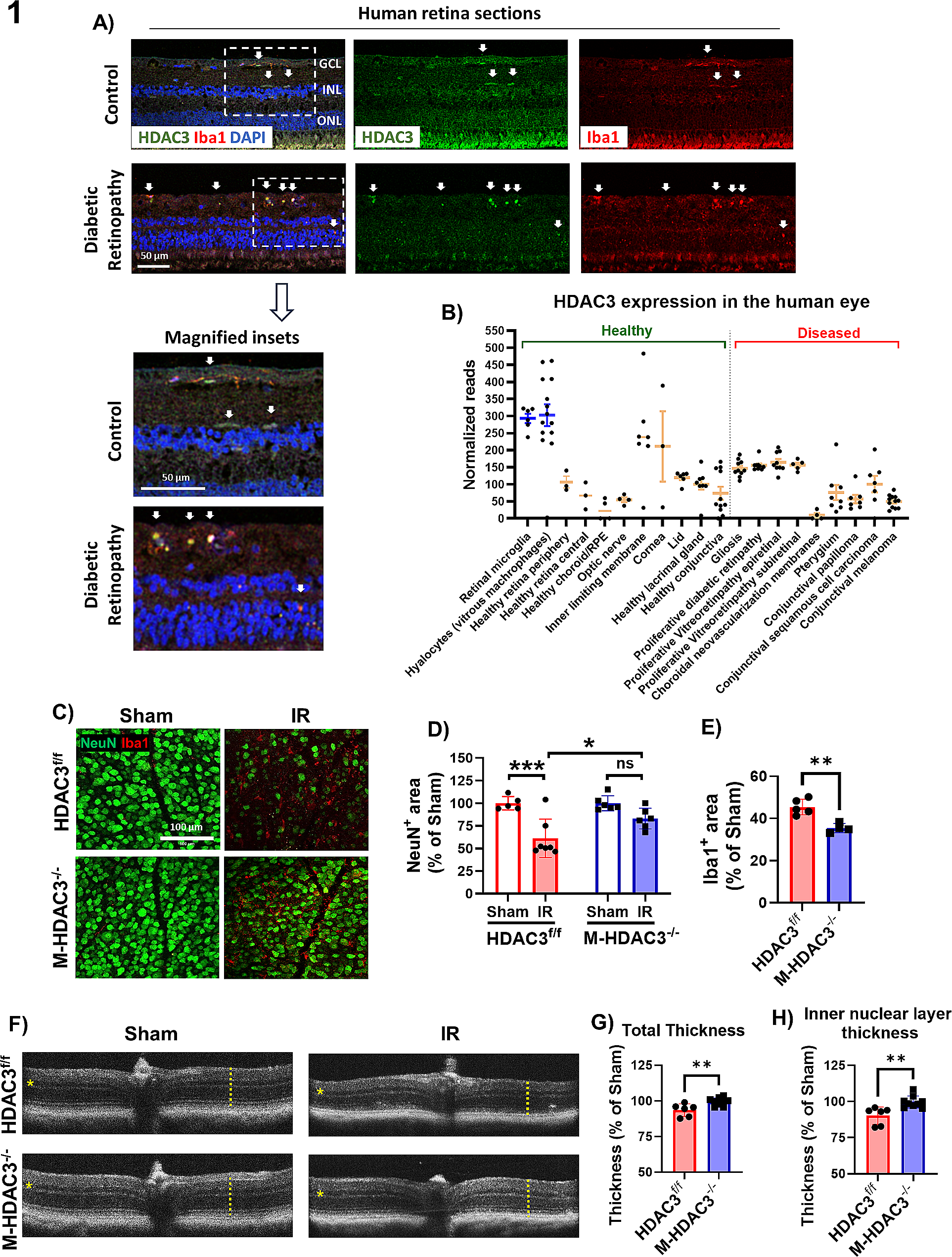 Deletion of myeloid HDAC3 promotes efferocytosis to ameliorate retinal ischemic injury