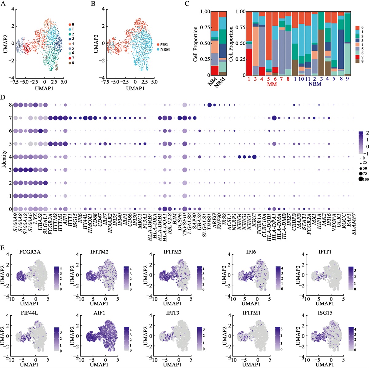 Identification of potential immune-related mechanisms related to the development of multiple myeloma