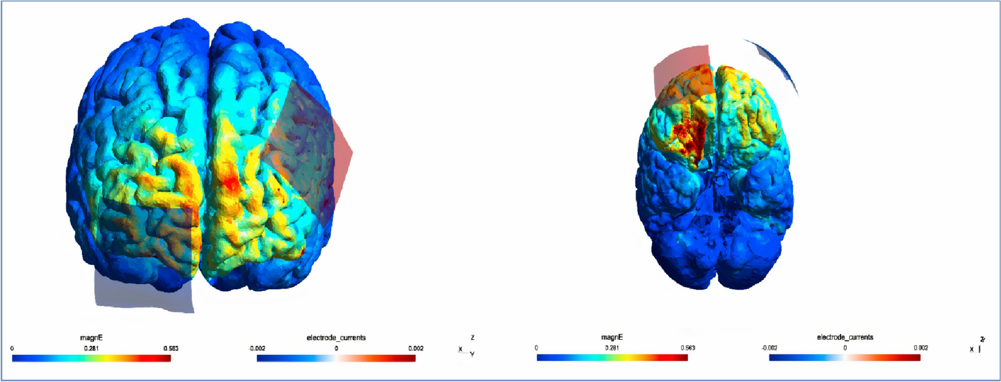 The impact of transcranial direct current stimulation on attention bias modification in children with ADHD