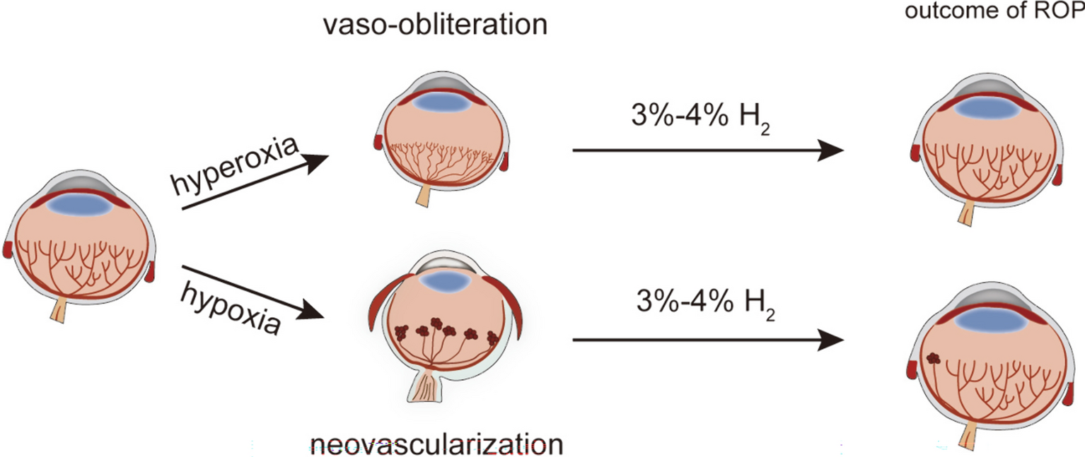 Molecular hydrogen promotes retinal vascular regeneration and attenuates neovascularization and neuroglial dysfunction in oxygen-induced retinopathy mice