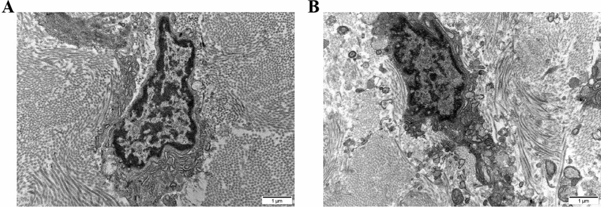 Correction: Role of hypoxia-mediated pyroptosis in the development of extending knee joint contracture in rats