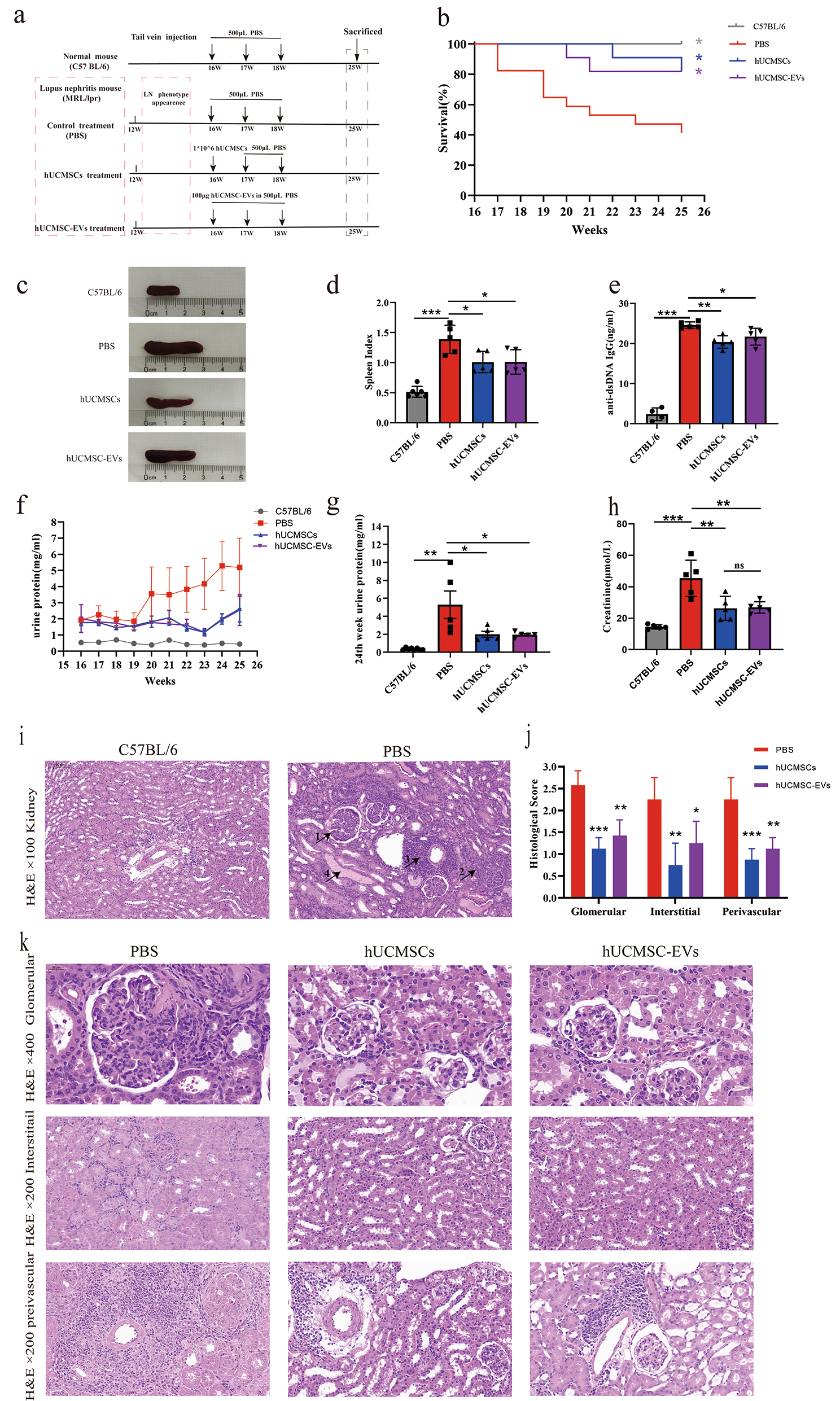 Mesenchymal stem cells-derived extracellular vesicles ameliorate lupus nephritis by regulating T and B cell responses