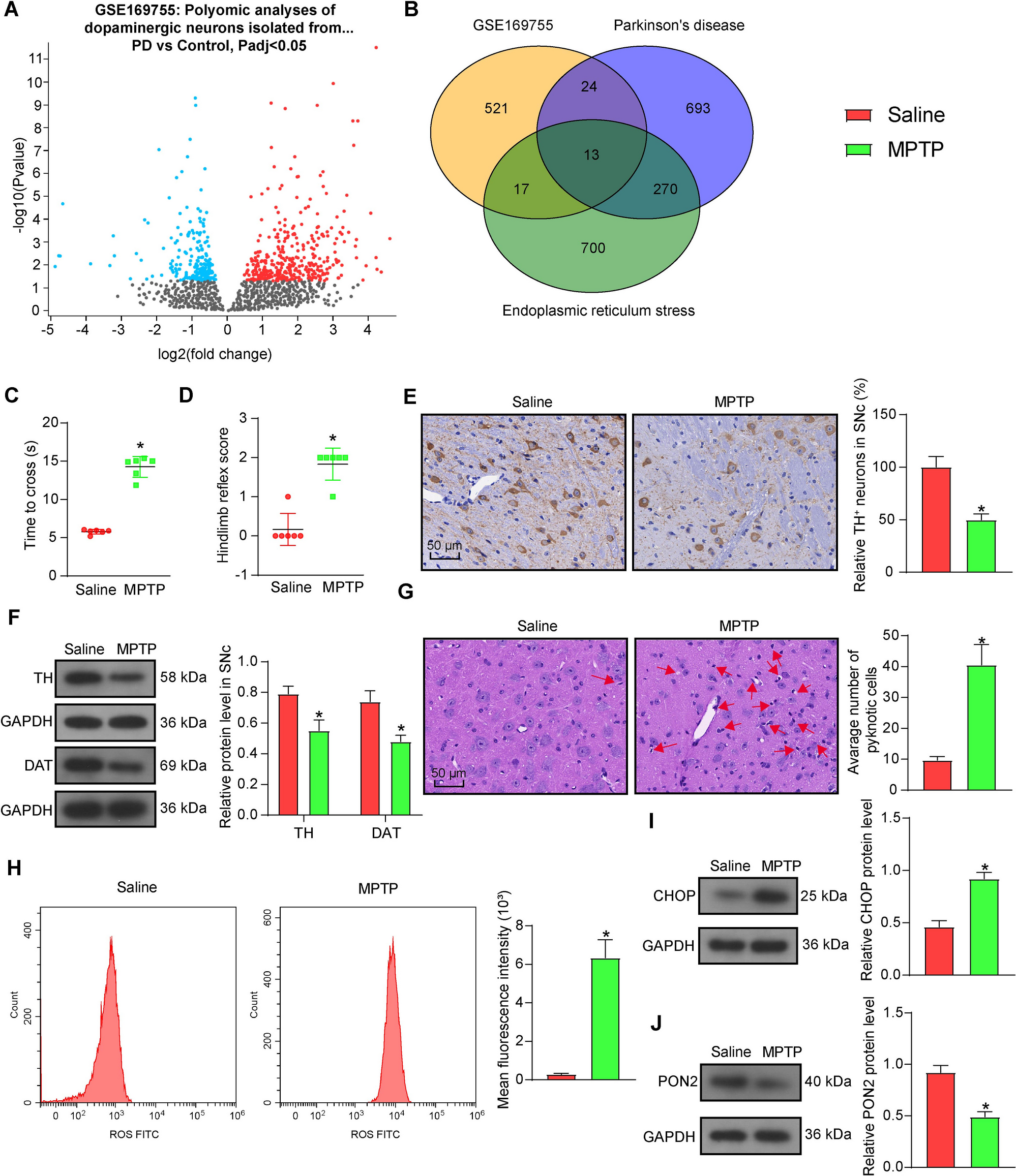 FOXA1 Suppresses Endoplasmic Reticulum Stress, Oxidative Stress, and Neuronal Apoptosis in Parkinson's Disease by Activating PON2 Transcription