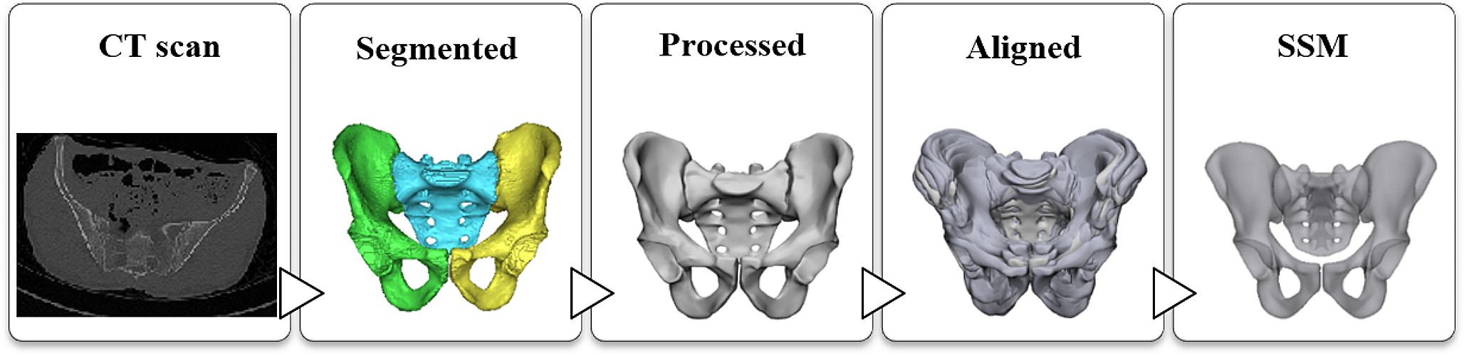 Evaluation of the superior pubic ramus and supra acetabular corridors using statistical shape modelling