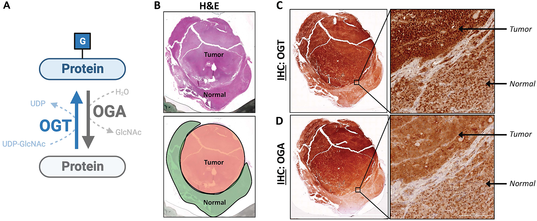 The diverging role of O-GlcNAc transferase in corticotroph and somatotroph adenomas