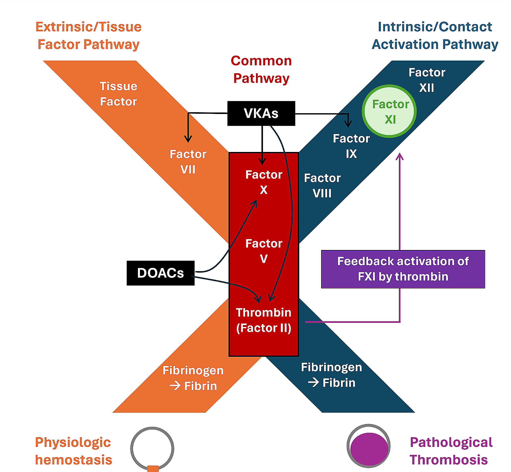Will Factor XI Inhibitors Replace Current Anticoagulants for Stroke Prevention in Atrial Fibrillation?