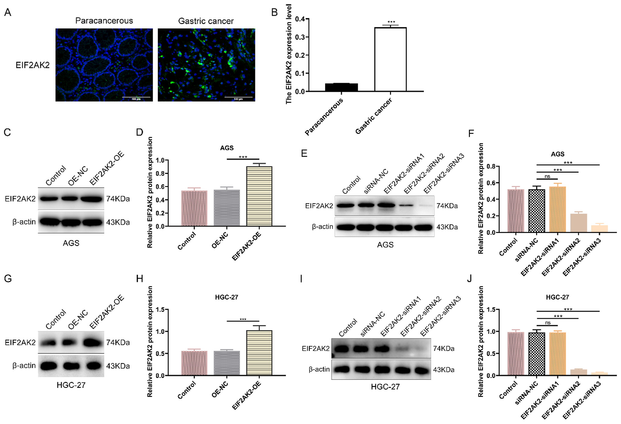 Knockdown of EIF2AK2-OAS1 axis reduces ATP production inducing AMPK phosphorylation to inhibit the malignant behavior of gastric cancer cells
