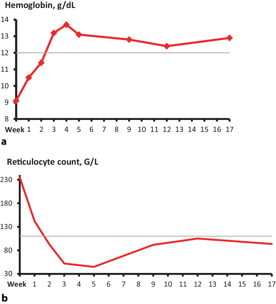 Resolution of extravascular hemolysis with oral iptacopan monotherapy in a patient with treatment experienced paroxysmal nocturnal hemoglobinuria (PNH)
