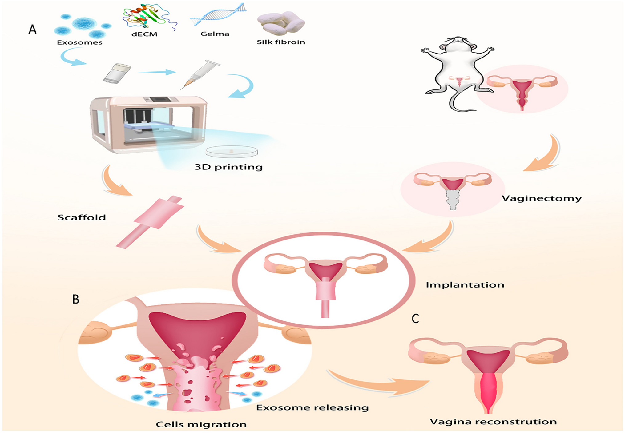 Desktop-Stereolithography 3D Printing of a Decellularized Extracellular Matrix/Mesenchymal Stem Cell Exosome Bioink for Vaginal Reconstruction