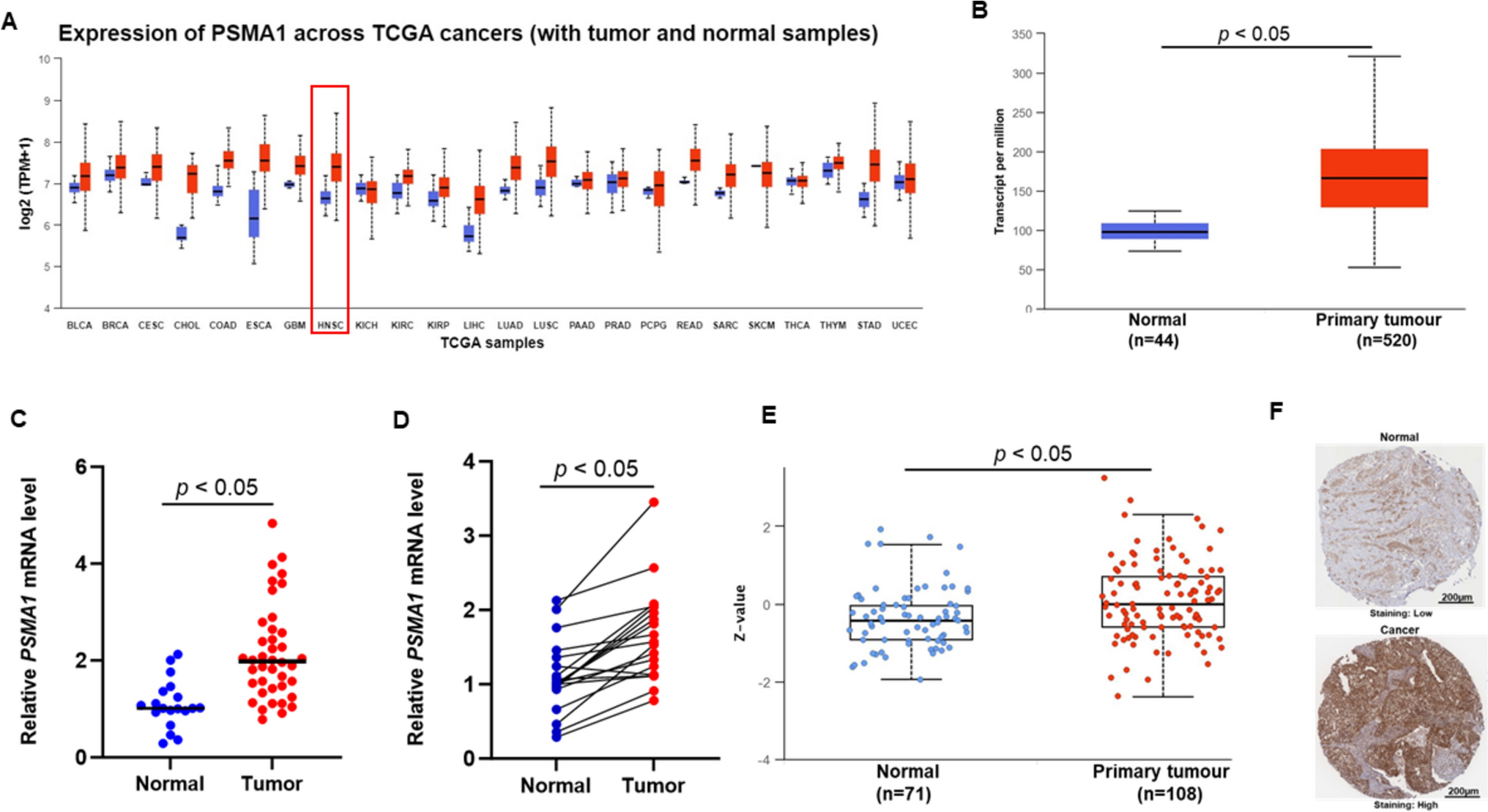 Aberrated PSMA1 expression associated with clinicopathological features and prognosis in oral squamous cell carcinoma