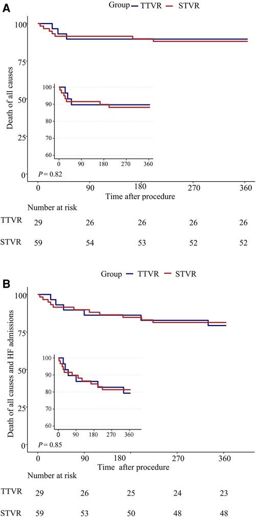 Comparison of clinical and echocardiographic outcomes between mini-thoracotomy transatrial LuX-Valve transcatheter and surgical tricuspid valve replacement