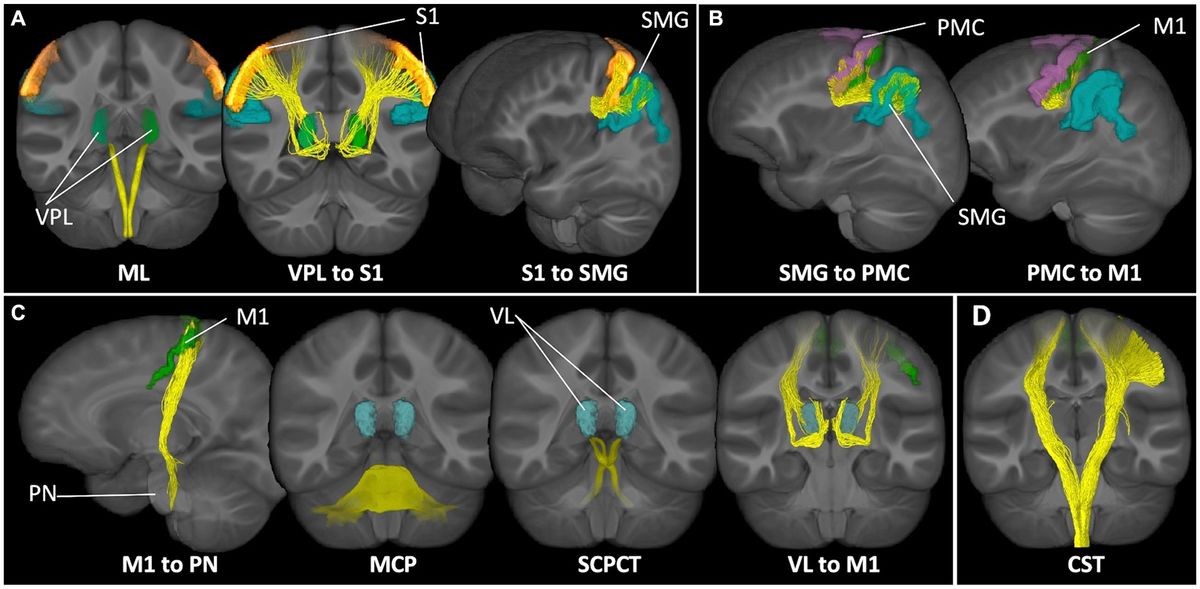 Microstructural neural correlates of maximal grip strength in autistic children: the role of the cortico-cerebellar network and attention-deficit/hyperactivity disorder features