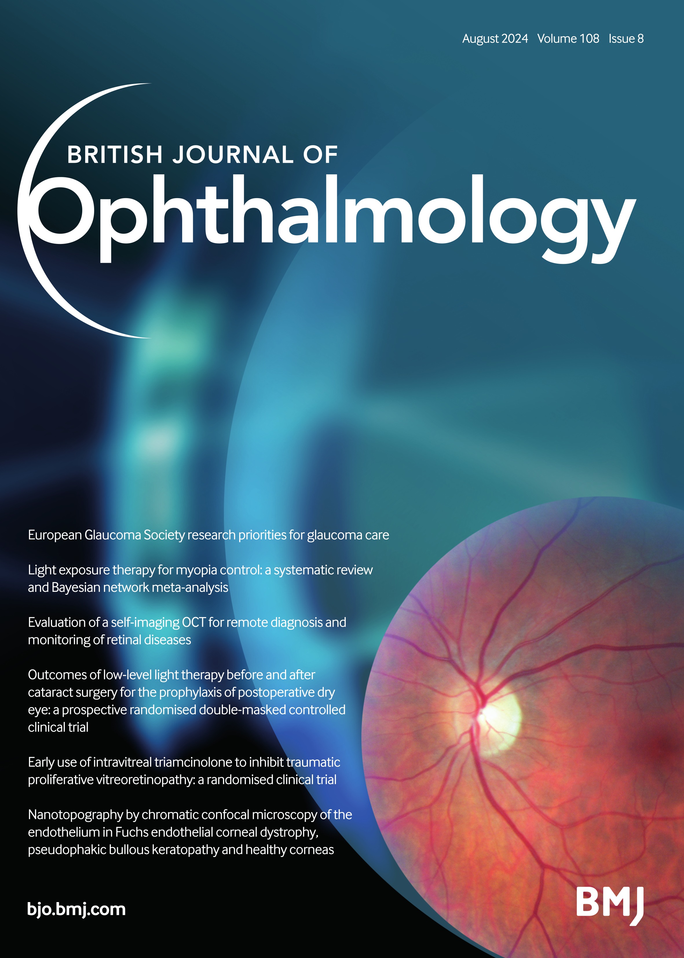 Diagnostic criteria of anterior segment swept-source optical coherence tomography to detect gonioscopic angle closure