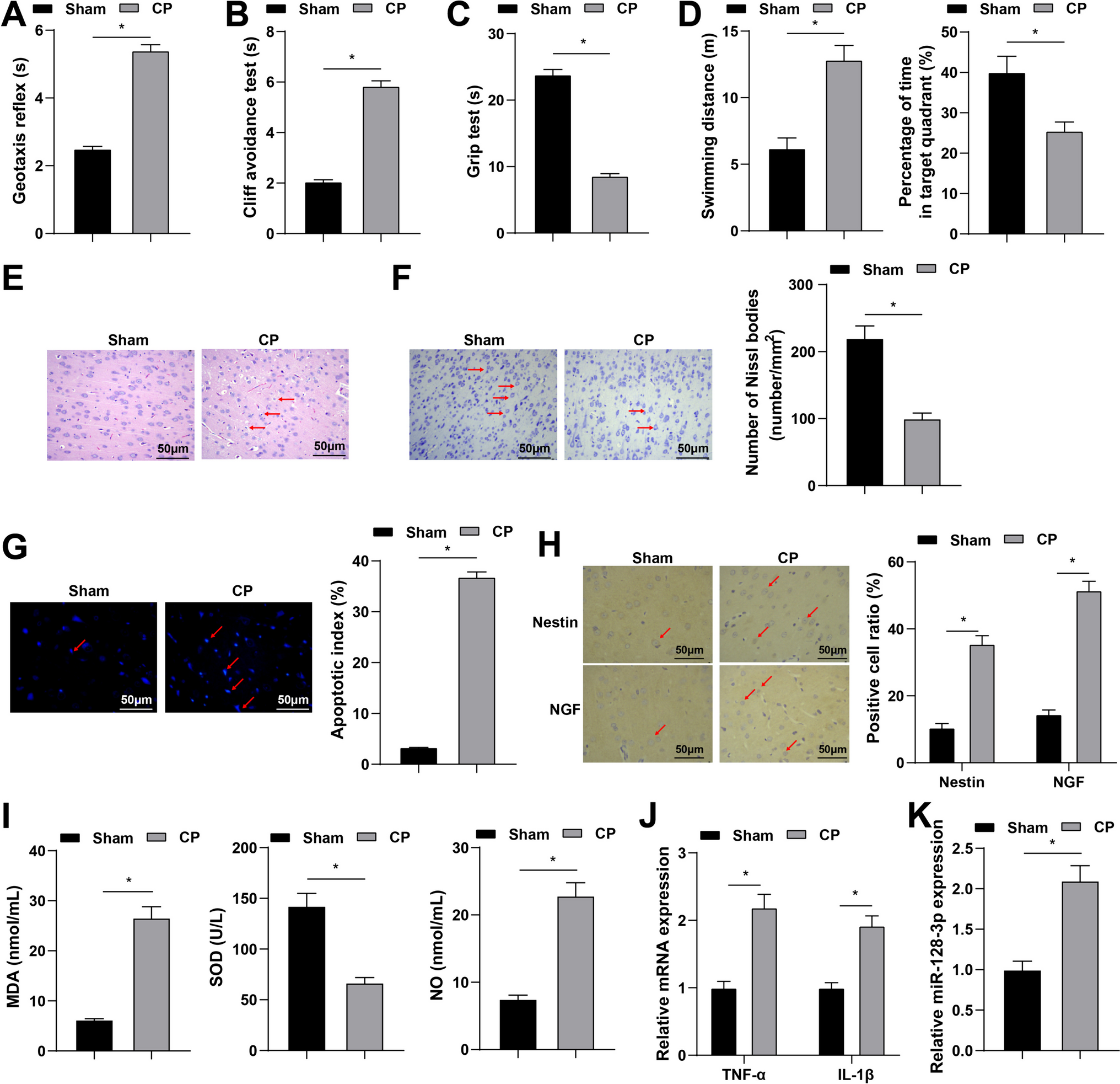 MicroRNA-128-3p Affects Neuronal Apoptosis and Neurobehavior in Cerebral Palsy Rats by Targeting E3 Ubiquitin-Linking Enzyme Smurf2 and Regulating YY1 Expression
