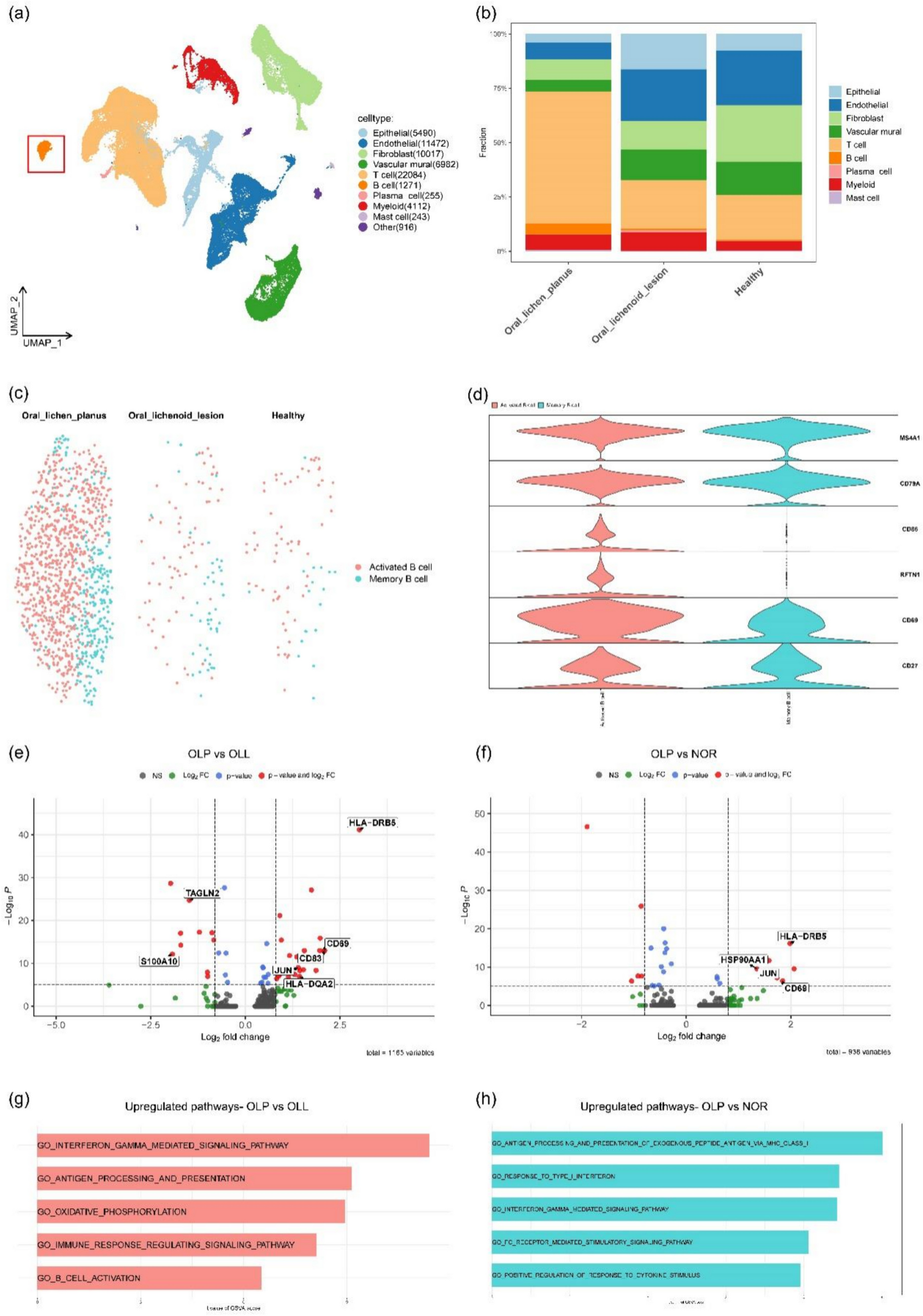 B Cells Infiltration Potentially Responded Better to Systemic Corticoids in Oral Lichen Planus and Oral Lichenoid Lesions