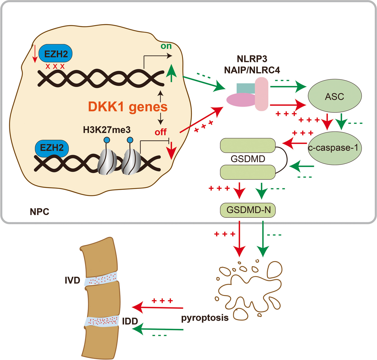 EZH2-H3K27me3-Mediated Epigenetic Silencing of DKK1 Induces Nucleus Pulposus Cell Pyroptosis in Intervertebral Disc Degeneration by Activating NLRP3 and NAIP/NLRC4