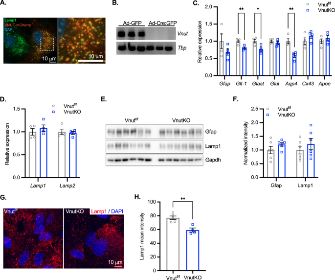 Deletion of murine astrocytic vesicular nucleotide transporter increases anxiety and depressive-like behavior and attenuates motivation for reward