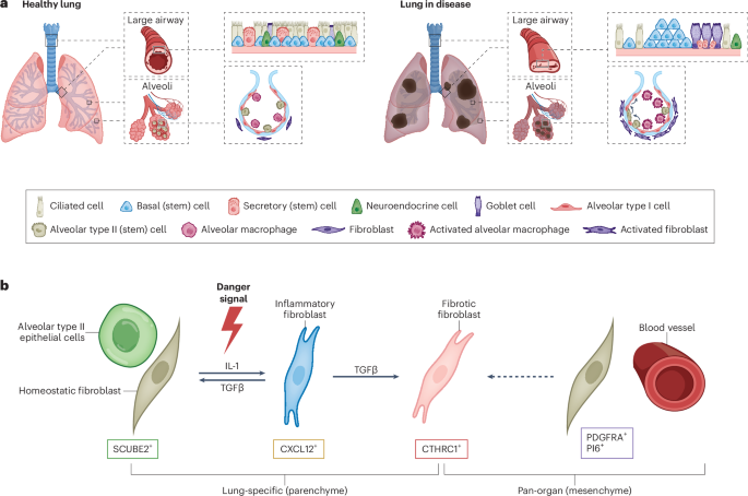 Tracing the origins of lung fibrosis