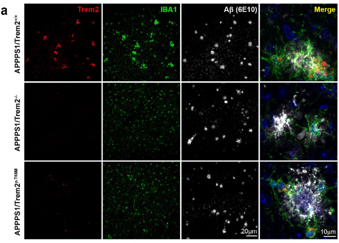 Author Correction: Loss of TREM2 function increases amyloid seeding but reduces plaque-associated ApoE