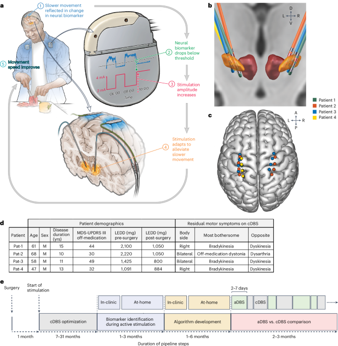 Chronic adaptive deep brain stimulation versus conventional stimulation in Parkinson’s disease: a blinded randomized feasibility trial