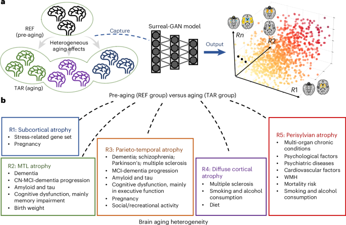 Brain aging patterns in a large and diverse cohort of 49,482 individuals
