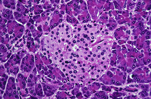 Combination therapy increases human β-cell mass in vivo