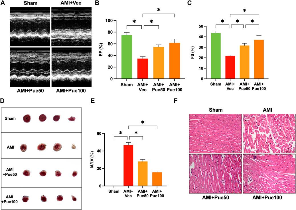 Puerarin attenuates myocardial ischemic injury and endoplasmic reticulum stress by upregulating the Mzb1 signal pathway