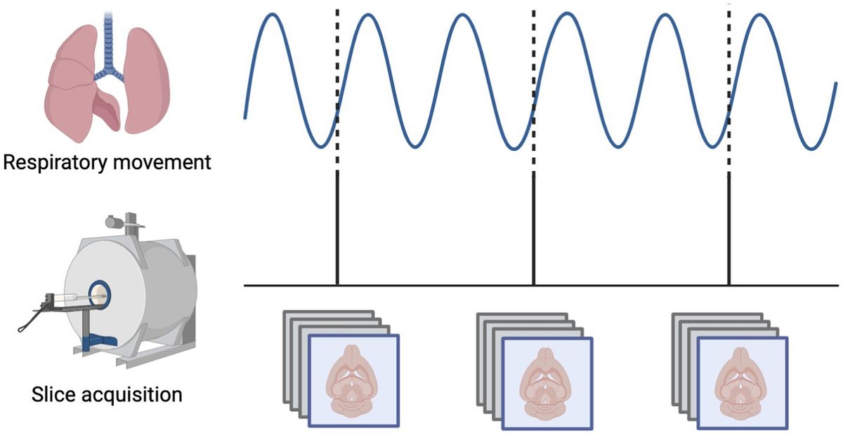 Variation in the distribution of large-scale spatiotemporal patterns of activity across brain states