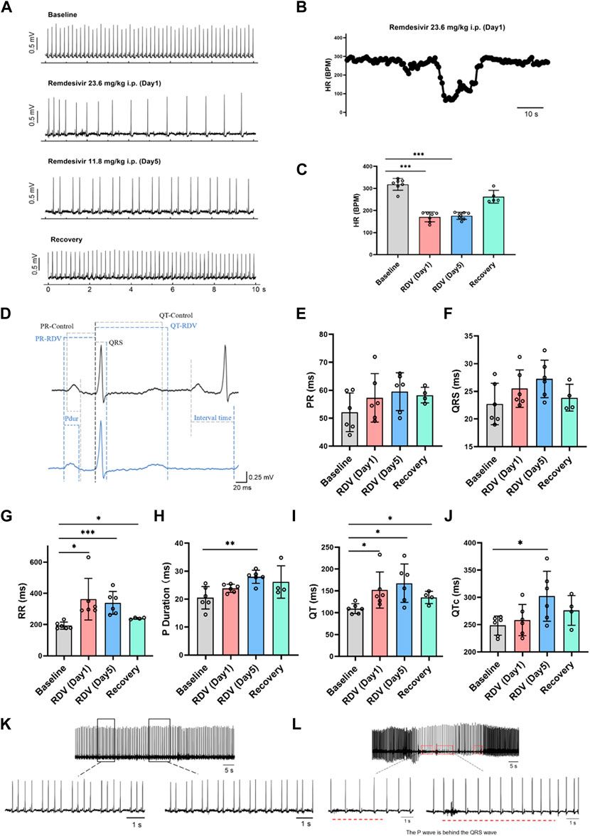 Electrophysiological and sick sinus syndrome effects of Remdesivir challenge in guinea-pig hearts