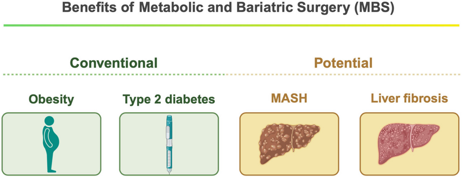 Resmetirom and Metabolic Dysfunction-Associated Steatohepatitis: Perspectives on Multidisciplinary Management from Global Healthcare Professionals