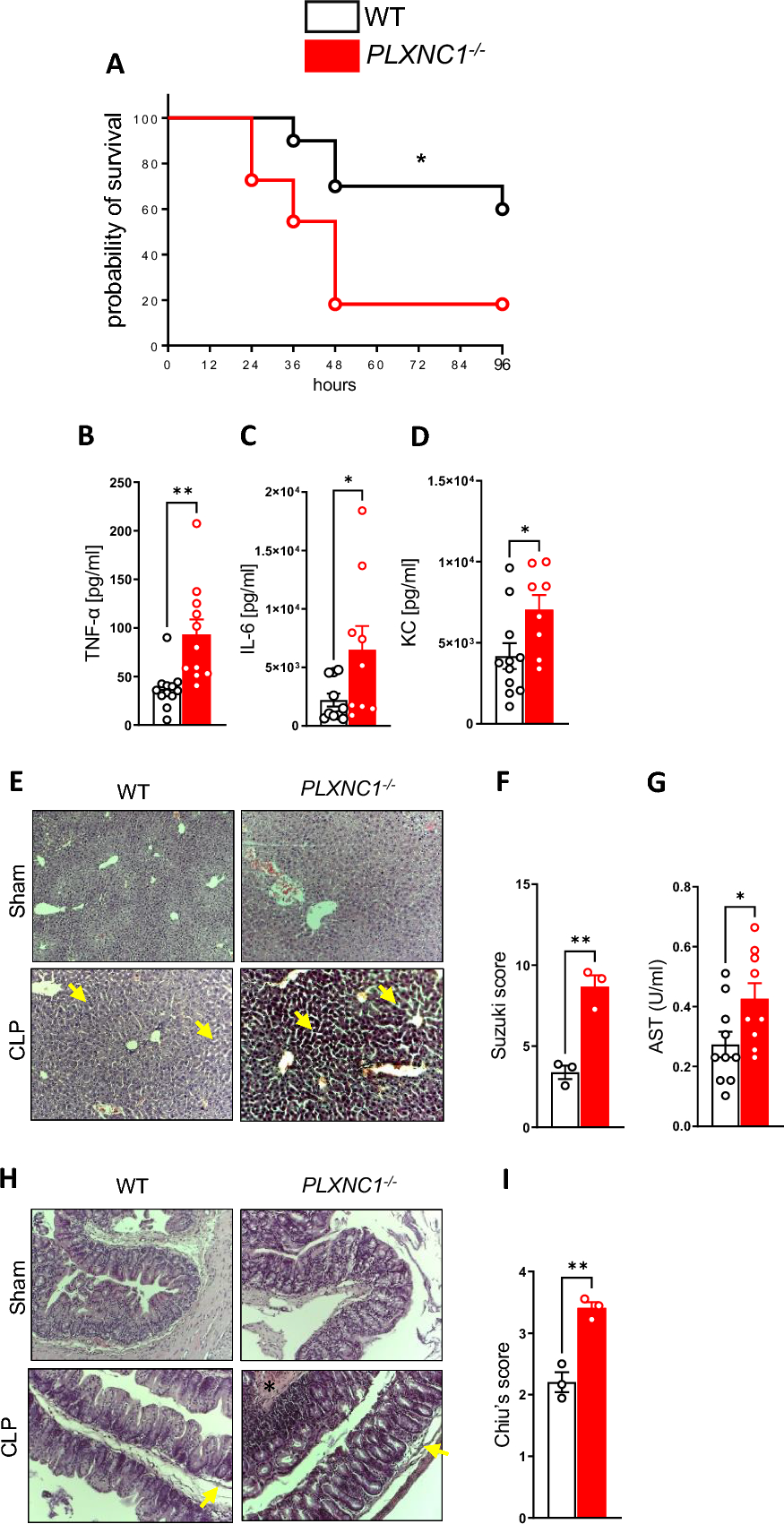 Plexin C1 influences immune response to intracellular LPS and survival in murine sepsis