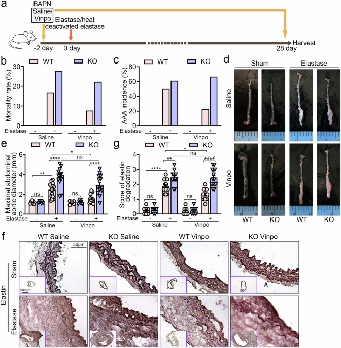 Vinpocetine alleviates the abdominal aortic aneurysm progression via VSMCs SIRT1-p21 signaling pathway