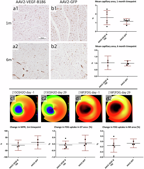 Correction: AAV2-VEGF-B gene therapy failed to induce angiogenesis in ischemic porcine myocardium due to inflammatory responses