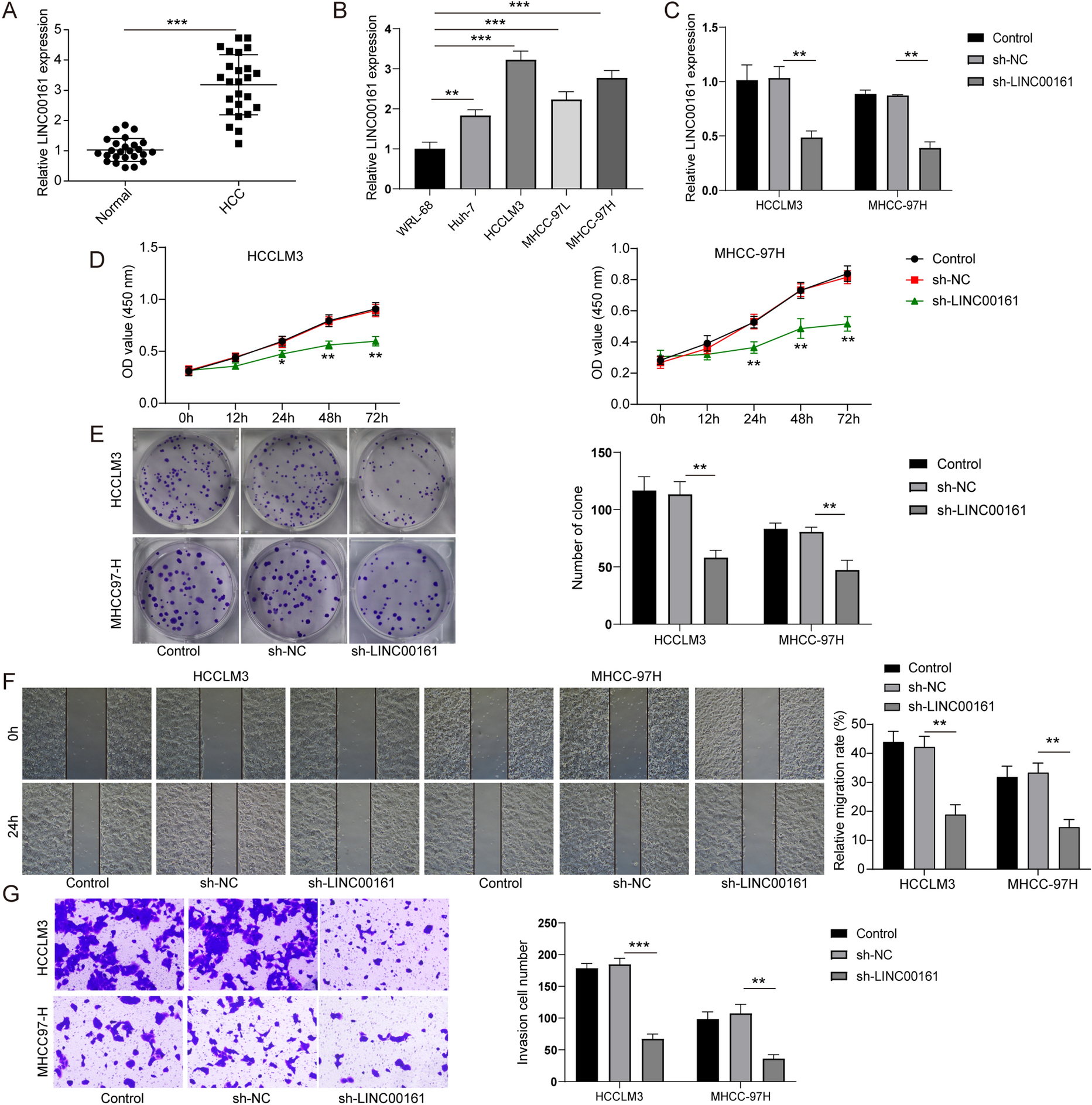 LINC00161 upregulated by M2-like tumor-associated macrophages promotes hepatocellular carcinoma progression by methylating HACE1 promoters