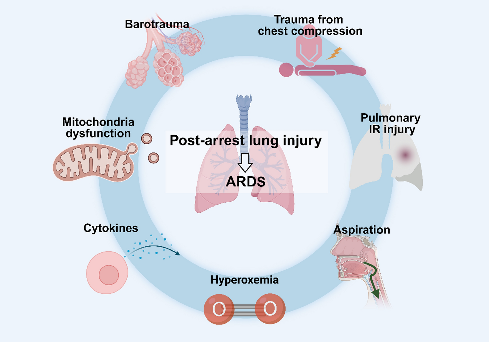 Acute lung injury and post-cardiac arrest syndrome: a narrative review