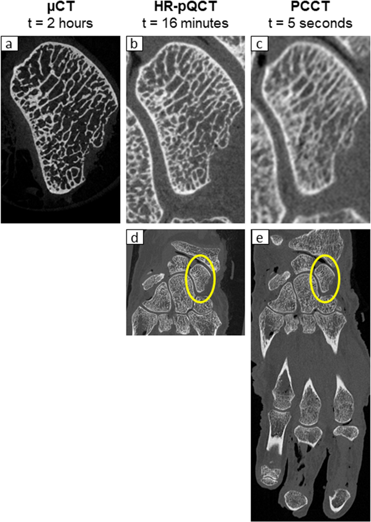 Photon-Counting Computed Tomography for Microstructural Imaging of Bone and Joints