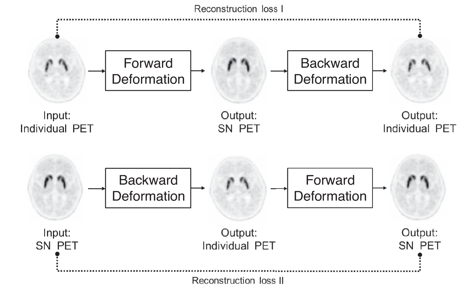 Accurate Automated Quantification of Dopamine Transporter PET Without MRI Using Deep Learning-based Spatial Normalization