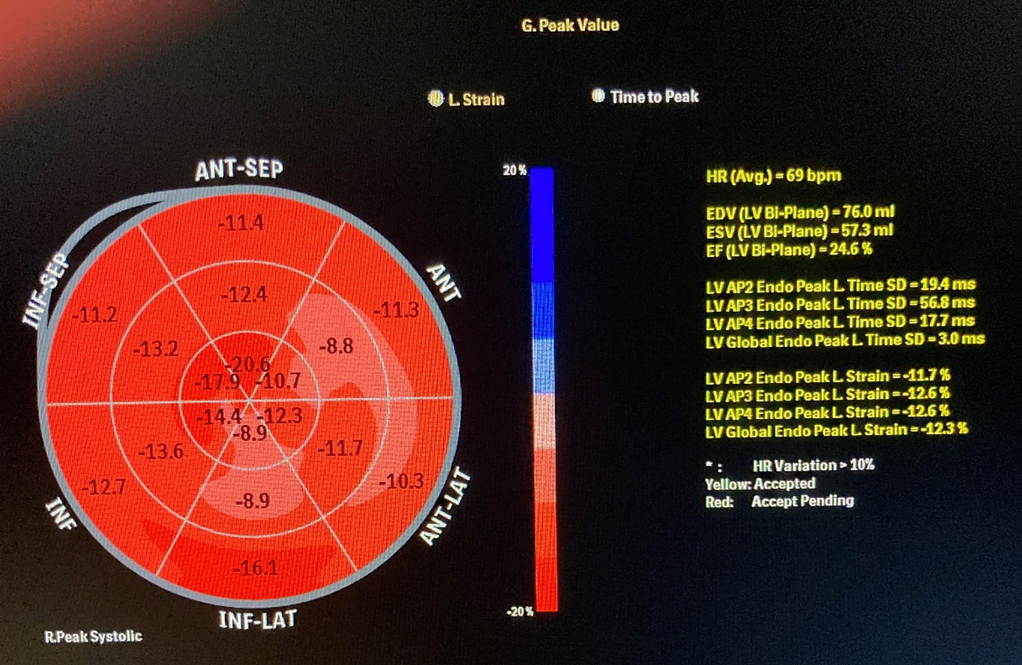 Cardiac response to hypertension treatment: an advanced echocardiographic evaluation