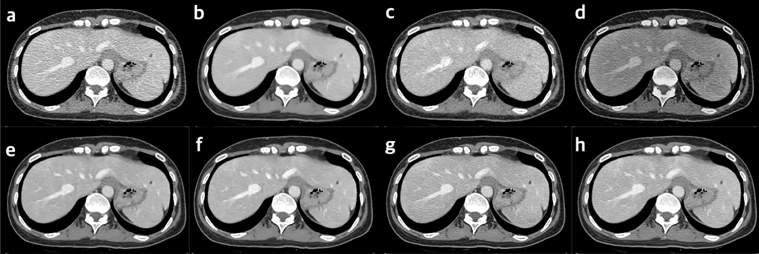 Self-supervised learning for CT image denoising and reconstruction: a review