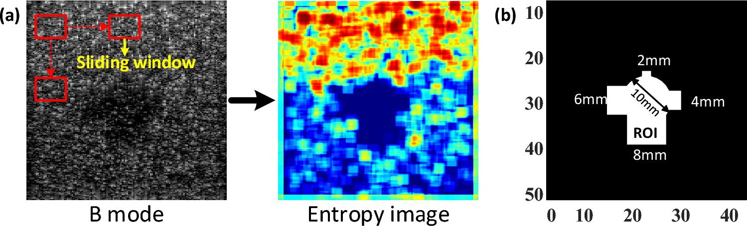 Pixel-based small-window parametric ultrasound imaging for liver tumor characterization